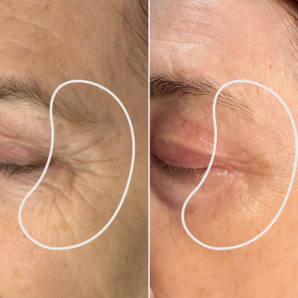 Seoul 1988 Eye Cream Retinal Liposome 4% + Fermented Bean