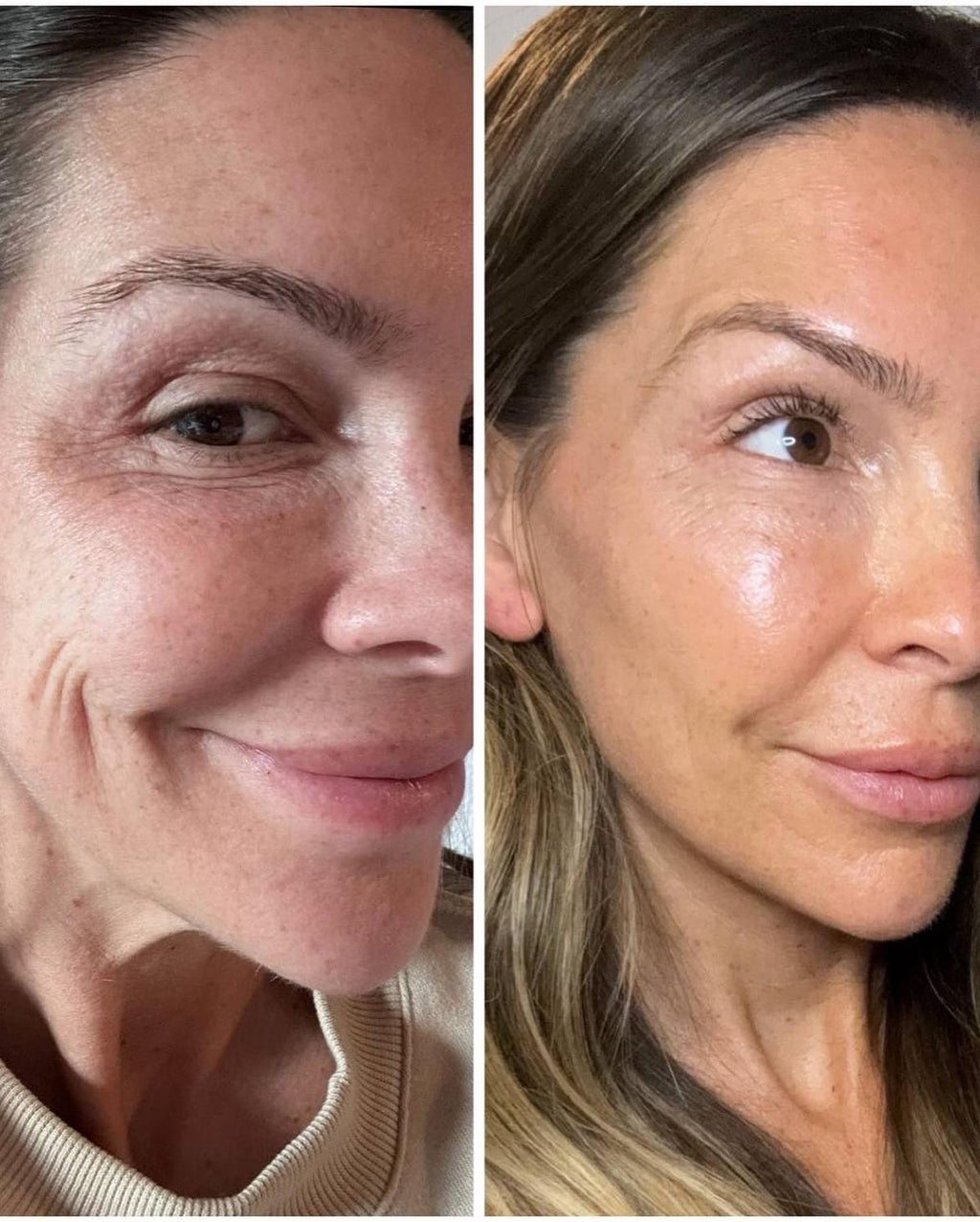 Triple Collagen Serum