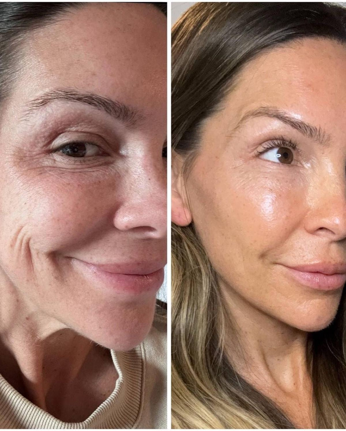 Triple Collagen Serum